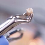 歯科治療後の腫れ・痛みを軽減する自宅でのアフターケア方法を解説