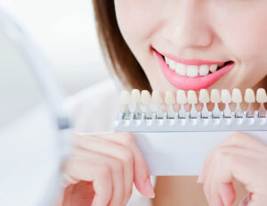 江戸川区•船堀の歯医者、中山歯科医院でホワイトニングについて解説