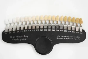 江戸川区•船堀の歯医者、中山歯科医院でホワイトニングについて解説