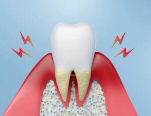 江戸川区船堀の歯医者、中山歯科医院で歯が浮く感覚の正体とは？歯根膜の炎症と噛み合わせの関係を解説