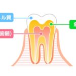江戸川区•船堀の歯医者、中山歯科医院で、歯のエナメル質が薄い人の特徴とは？遺伝と環境要因の影響を解説