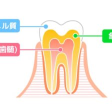 江戸川区•船堀の歯医者、中山歯科医院で、歯のエナメル質が薄い人の特徴とは？遺伝と環境要因の影響を解説