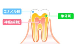 江戸川区•船堀の歯医者、中山歯科医院で、歯のエナメル質が薄い人の特徴とは？遺伝と環境要因の影響を解説